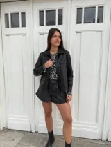 Chaqueta dorada metalizada con cuello camisero, cierre frontal con botones y bolsillos de parche en el pecho.