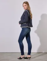 Jean skinny de tiro alto color azul con desgaste.